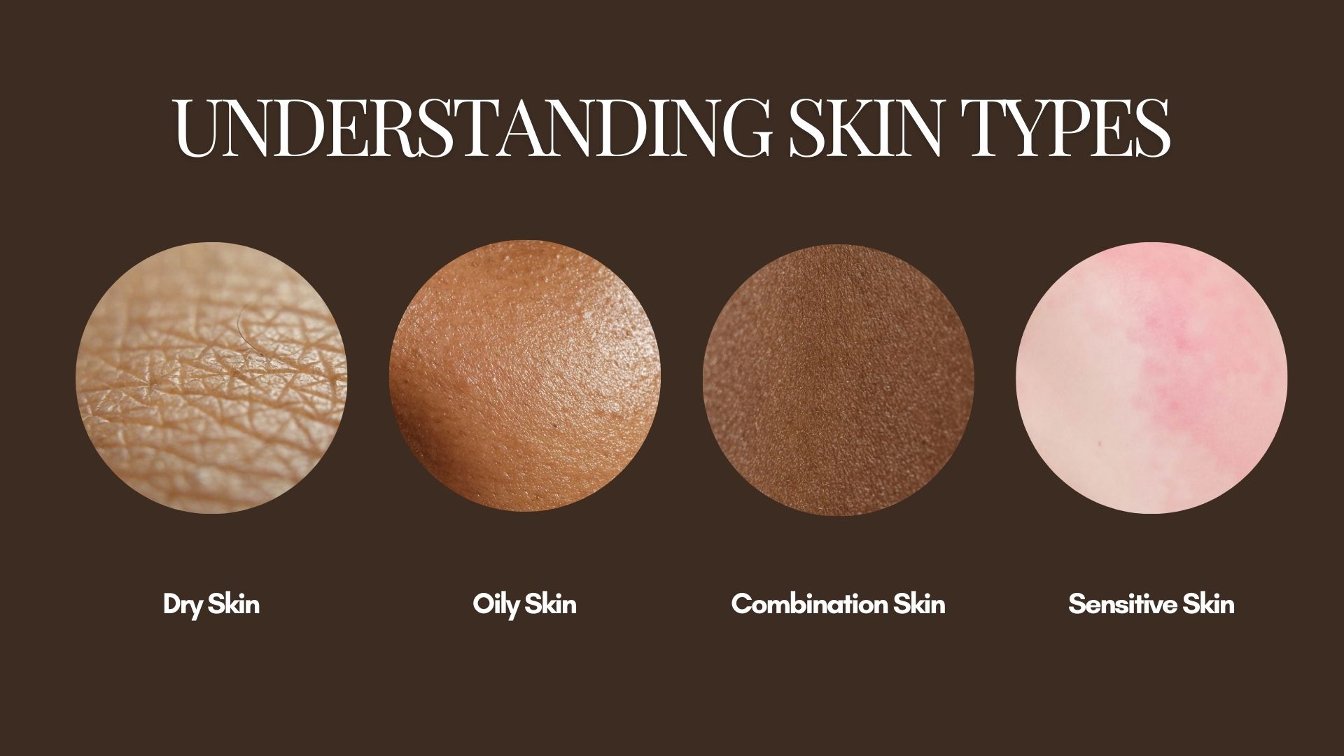 What is Sensitive Skin?